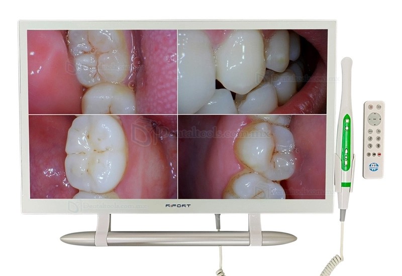 Magenta YF-2200M C&aacute;mara intraoral WiFi con monitor de 21.5